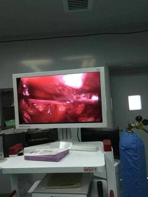我院胸外科成功完成一例腹腔镜全腹膜外左腹股沟斜疝无张力修补术.webp